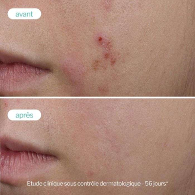 NOVEXPERT - Serum booster trio zinc anti imperfections anti